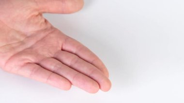 Dişlerin düzeltilmesi için göstericileri temizleyin. Yüksek kalite 4k görüntü