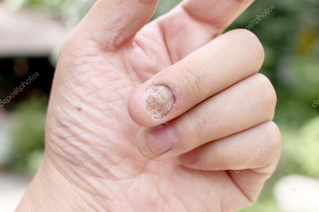 Characteristics Tissue Skin Finger Human Nail Stock Photo 2275236041 |  Shutterstock