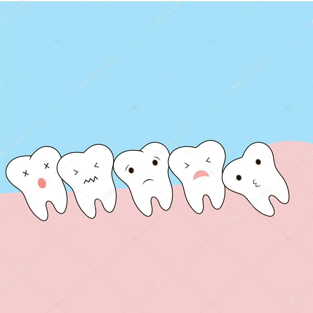 Problems caused by impacted wisdom teeth include. Sleepy tooth of impacted tooth. dystopic teeth. funny cartoon illustration of the emotions of the teeth, for children information in dentistry