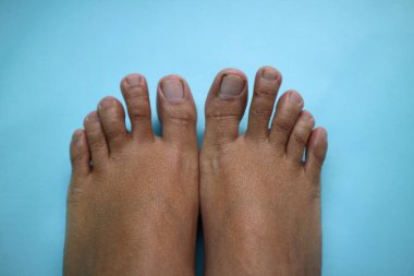 Açık mavi bir arka planda çıplak ayakla yakın çekim. Görüntü, deri dokusu ve ayak parmağı detaylarını gösterir.