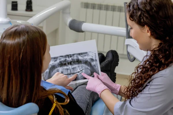 牙科医生在诊所向他的病人解释X光牙齿照片的细节 口腔护理 — 图库照片