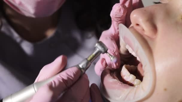 牙科医生在牙科诊所为年轻的女病人清洁专业的牙齿 清理结束计划 — 图库视频影像