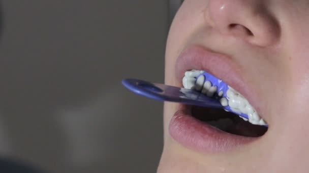 Den Ortodontist Bruger Dental Indtryk Bakke Kvinde Tænder – Stock-video