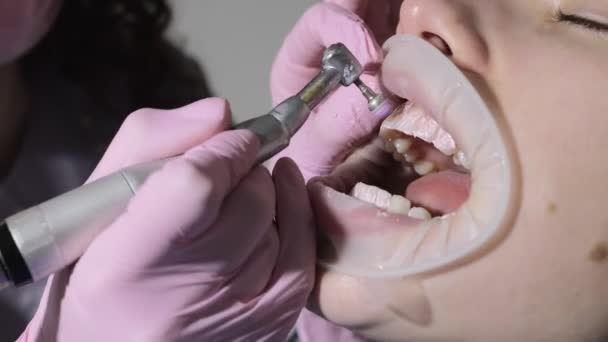 Dentista Fazendo Dentes Profissionais Limpeza Jovem Paciente Sexo Feminino Consultório — Vídeo de Stock