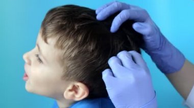 Eldivenli çocuk doktoru küçük bir çocuktaki bit ve bitleri kontrol edecek. Anaokulunda pediküloz, kafa ve saçın önleyici muayenesi.