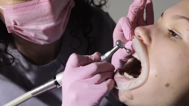 Zubař dělá profesionální čištění zubů u mladé pacientky v zubní ordinaci. Podrobný plán — Stock video