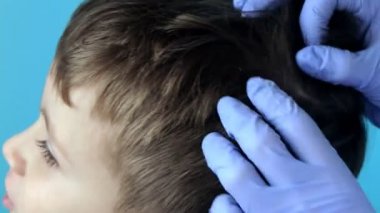 Eldivenli çocuk doktoru küçük bir çocuktaki bit ve bitleri kontrol edecek. Anaokulunda pediküloz, kafa ve saçın önleyici muayenesi.