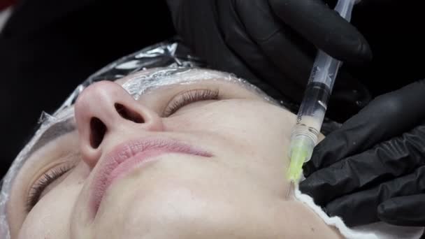 Cosmetoloog Arts Het Maken Van Meerdere Injecties Biorevitalisatie Met Hyaluronzuur — Stockvideo