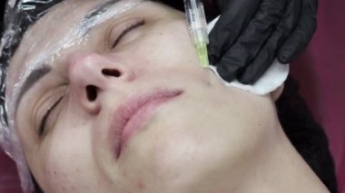 Kozmetik uzmanı kadın derisine hiyalüronik asitle birden fazla enjeksiyon yapıyor, yakın plan. Kadın mesoterapi uygulaması.