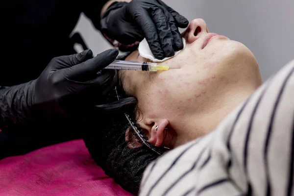 Cosmetoloog Arts Maakt Meerdere Injecties Biorevitalisatie Met Hyaluronzuur Gezichtshuid Van — Stockfoto