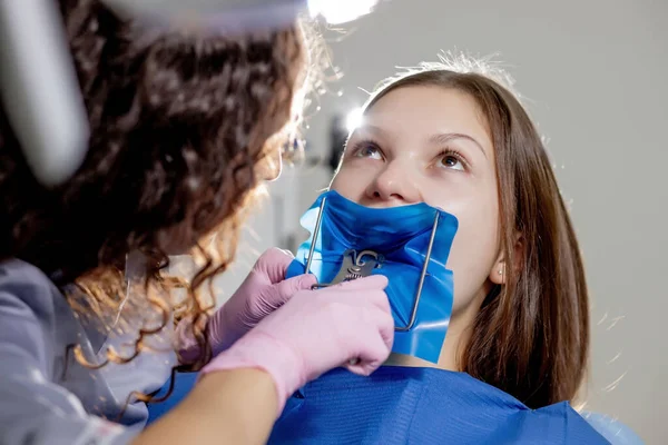 Klinikte Diş Beyazlatma Için Dişçiye Giden Bir Kadının Yakın Plan — Stok fotoğraf