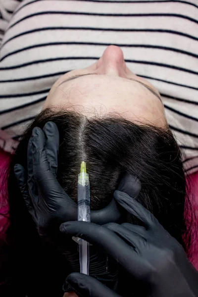Jarum Mesoterapi Cosmetologist Membuat Suntikan Kepala Wanita Memperkuat Rambut Dan — Stok Foto