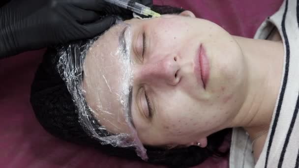 Procedura Mesoterapia Viso Salone Bellezza Estetista Medico Iniezioni Nella Pelle — Video Stock