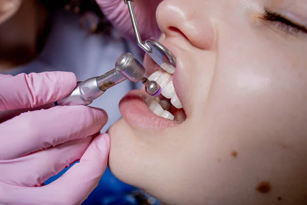 Dentist making professional teeth cleaning female young patient at the dental office. Close-up plan.