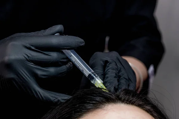 Naaldmesotherapie Cosmetoloog Maakt Injecties Vrouwenhoofd Versterken Het Haar Hun Groei — Stockfoto