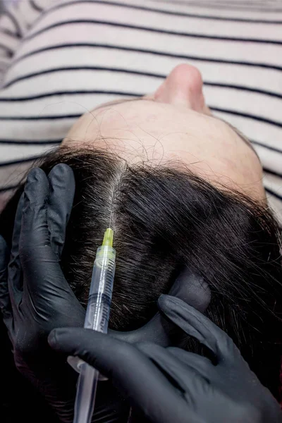 Naaldmesotherapie. cosmetoloog maakt injecties in vrouwenhoofd. versterken het haar en hun groei — Stockfoto