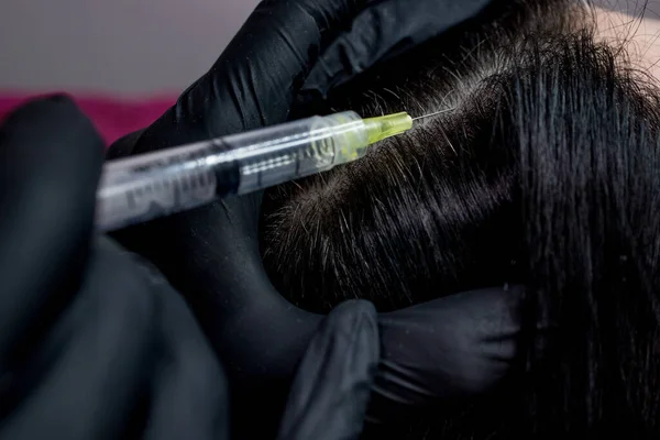 Naaldmesotherapie Cosmetoloog Maakt Injecties Vrouwenhoofd Versterken Het Haar Hun Groei — Stockfoto