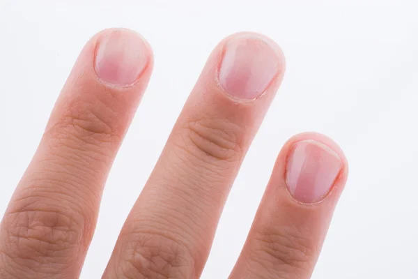 Hand, vingers en nagels op een witte achtergrond — Stockfoto