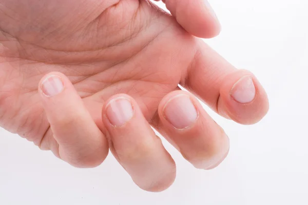 Mão, dedos e unhas sobre um fundo branco — Fotografia de Stock