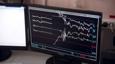 Tanınmayan doktor kontrolleri işlemi hastane ameliyathane bilgisayar ekranlarında performans.