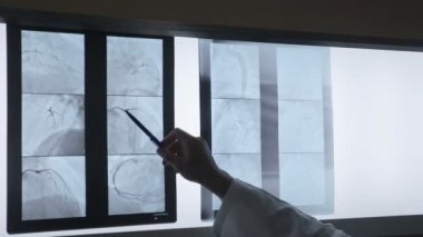 Doktorlar kol muayene röntgen filmi, grafisi.