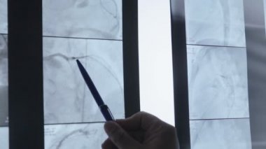 Doktorlar kol muayene röntgen filmi, grafisi. Yakın çekim.