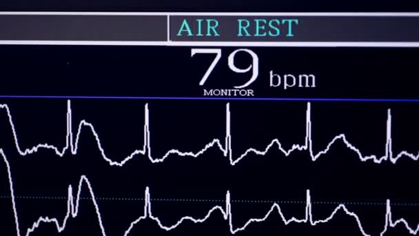 Πραγματική καρδιογράφημα. Εργασίας καρδιογράφο σε Καρδιολογικό νοσοκομείο. — Αρχείο Βίντεο