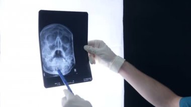 Profesyonel doktor x-ray tarama ile çalışma.