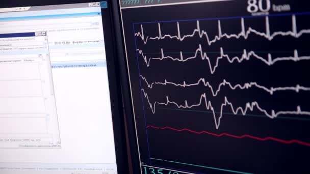 Battito cardiaco reale . — Video Stock