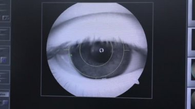 Modern otomatik makine göz küresi incelenmesi. Göz muayene testi bir profesyonel tıbbi ekipman ekran üzerinde.