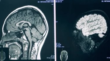 MR çekilirken hastaların taramaları devam ediyor