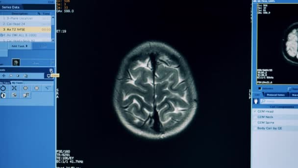 อินเทอร์เฟซของโปรแกรมคอมพิวเตอร์ MRI ระหว่างการสแกนหัว — วีดีโอสต็อก