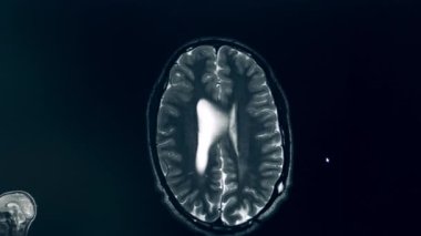 MRI işlemi sırasında beynin bilgisayar görüntüsü