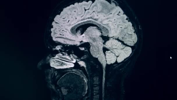 CT scan dari pasien kepala dalam dinamis — Stok Video