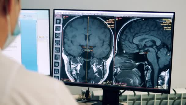 El trabajador médico está investigando la tomografía computarizada en el ordenador — Vídeos de Stock