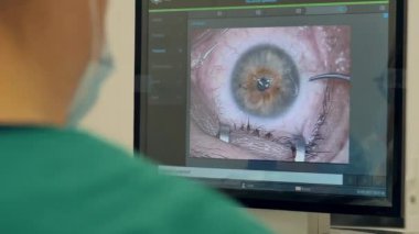 Üzerinde göz ameliyatı olan bilgisayar monitörü gösteriliyor
