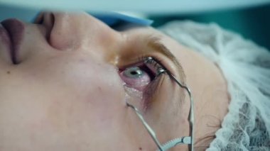 Bayan hasta lazer düzeltme ameliyatı oluyor.