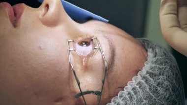 Anestezi hastaların gözüne dökülüyor.