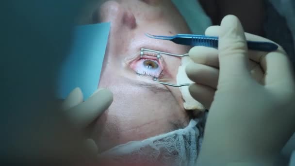 Dokter opereert patiënten oog — Stockvideo