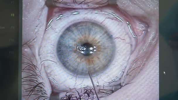 Відеозображення сітківки відділяється від очей — стокове відео