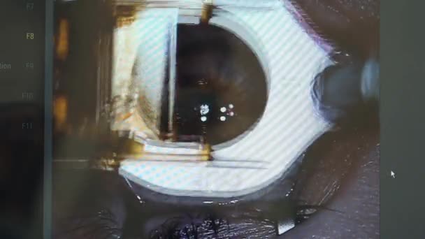 Funcționarea ochilor cu microkeratom se aplică — Videoclip de stoc