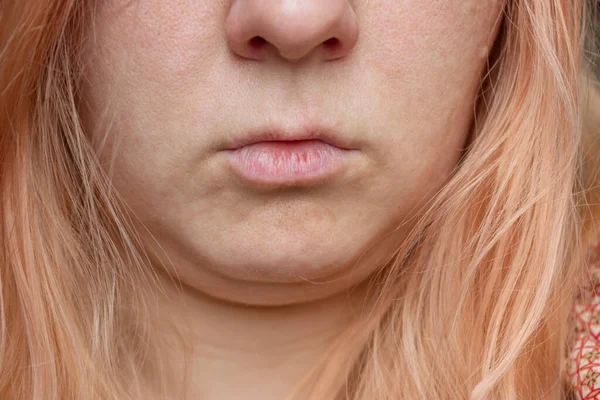 Närbild porträtt av en flicka med orange hår utan makeup och hud retuschering. — Stockfoto