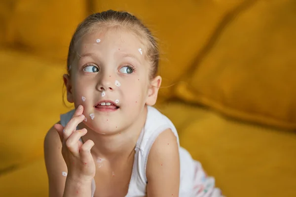 Retrato Uma Menina Sorridente Com Varicela Criança Doente Com Varicela — Fotografia de Stock