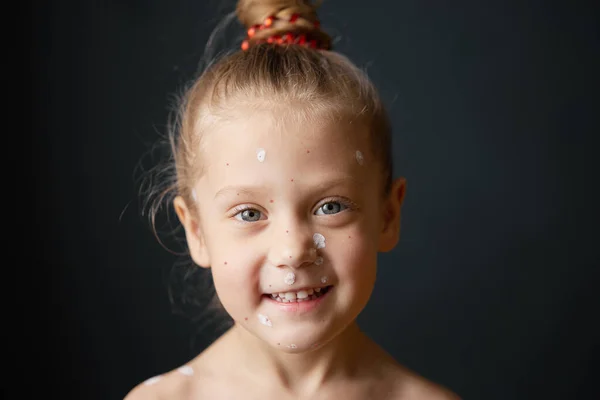 Retrato Uma Criança Com Varicela Criança Doente Com Varicela Vírus — Fotografia de Stock