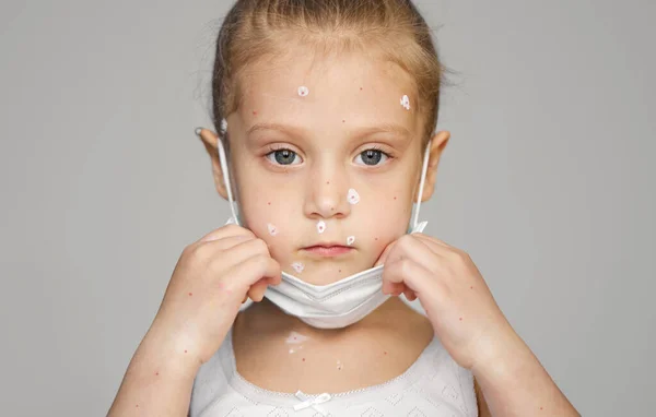 Retrato Menina Criança Doente Com Varicela Máscara Protetora Criança Com — Fotografia de Stock