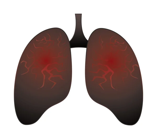 Pulmón del fumador, concepto de no fumar — Archivo Imágenes Vectoriales