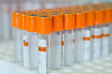 Turuncu kapak ile kan analizi için tıbbi test tüpleri