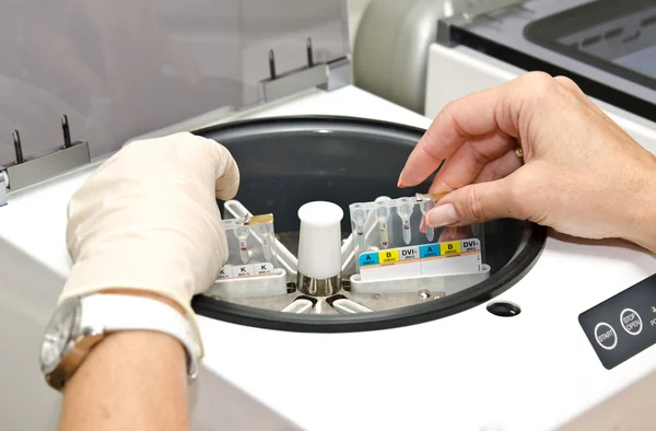 연구를 위한 실험실 원심 분리기에 튜브를 삽입 — 스톡 사진