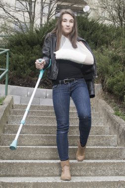 youngs kadın, alçı el, palm personel