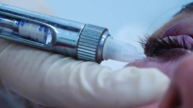 Bir cerraha yaklaşmak hastanın gözüne enjeksiyon yapar. Estetik ameliyat. Transkonjonktival blefaroplasti. Göz ameliyatı.